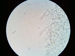 Orbilia crenatomarginata