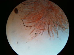 Trichosphaeria