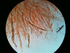 Trichosphaeria