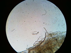 Trichosphaeria