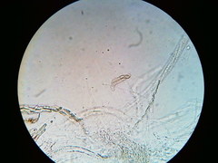 Trichosphaeria