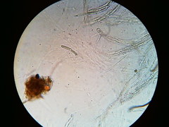 Trichosphaeria