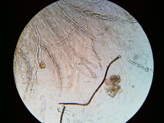 Trichosphaeria