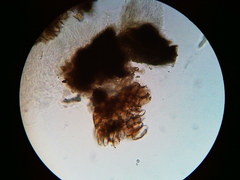 Trichosphaeria