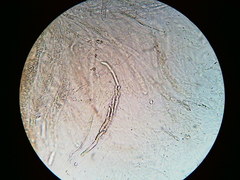Trichosphaeria