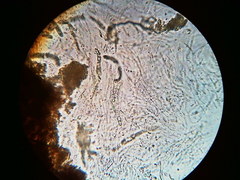 Trichosphaeria