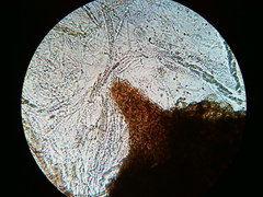 Trichosphaeria