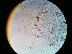 Trichosphaeria
