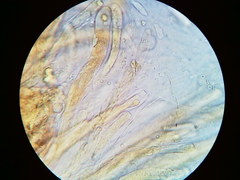 Trichosphaeria