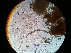 Trichosphaeria