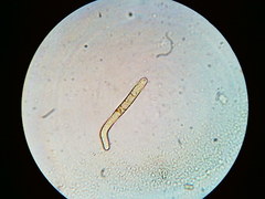 Trichosphaeria