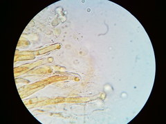 Trichosphaeria