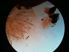 Trichosphaeria