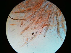 Trichosphaeria