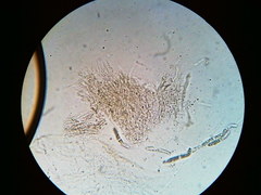 Trichosphaeria