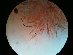 Trichosphaeria