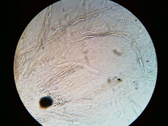 Trichosphaeria
