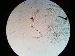 Trichosphaeria