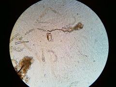 Trichosphaeria