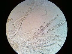 Trichosphaeria