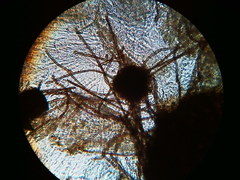 Trichosphaeria