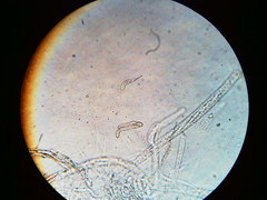 Trichosphaeria