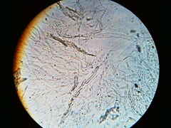 Trichosphaeria