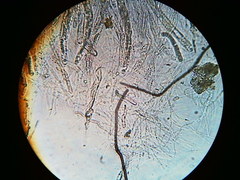 Trichosphaeria