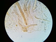 Trichosphaeria