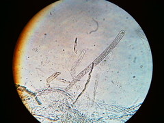 Trichosphaeria