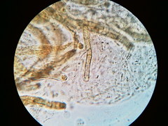 Trichosphaeria