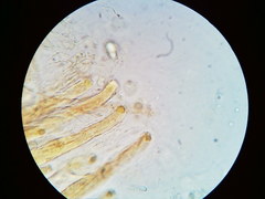 Trichosphaeria