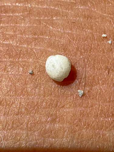 Cleotrivia globosa observed 2026-05-27