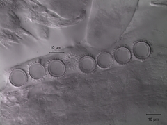 Pachyphlodes austro-oregonensis