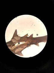 Chondracanthus teedei