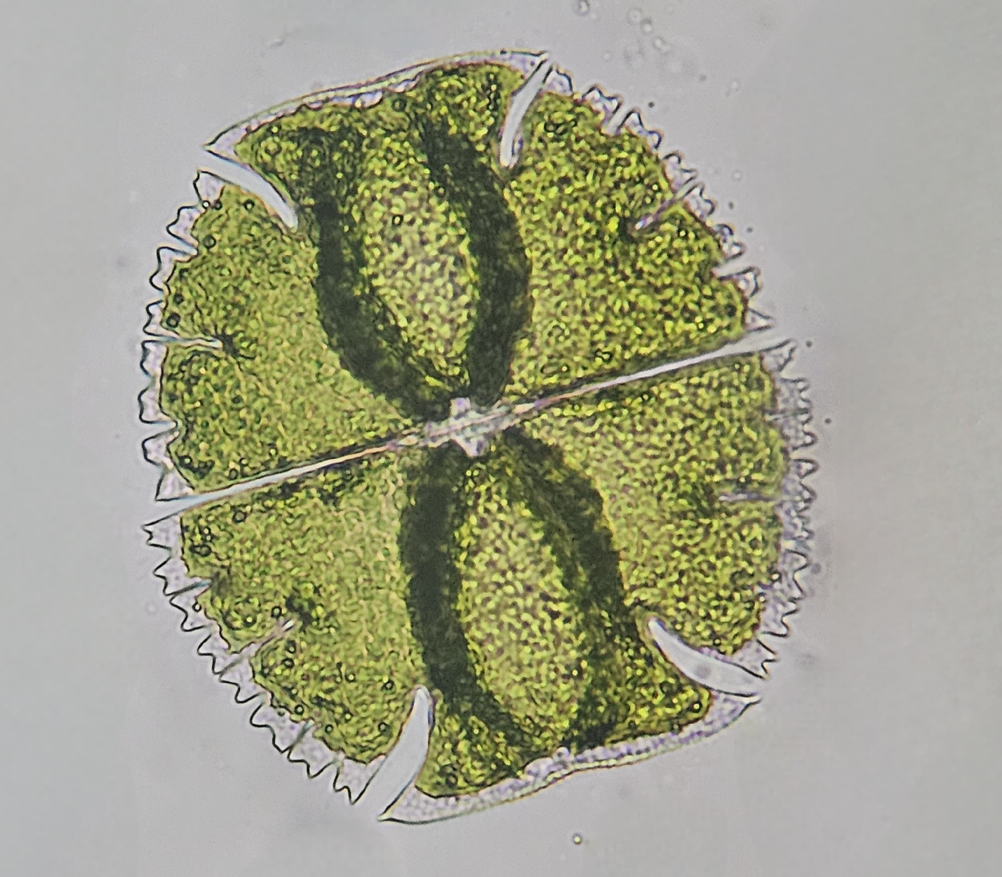 Micrasterias triangularis