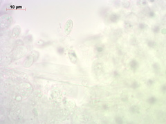 Melanoleuca strictipes