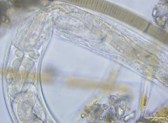 Nematoda