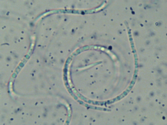 Acanthohelicospora aurea