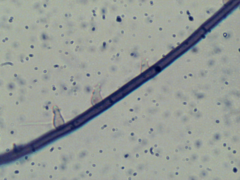 Acanthohelicospora aurea