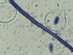 Acanthohelicospora aurea
