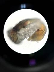 Chondracanthus acicularis