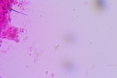 Clitopilus