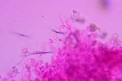 Clitopilus