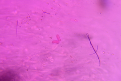 Auricularia mesenterica