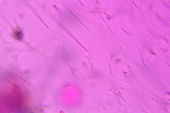 Auricularia mesenterica