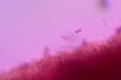 Auricularia mesenterica