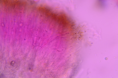 Auricularia mesenterica