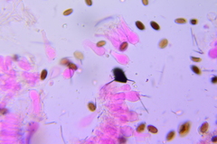 Psathyrella microrhiza