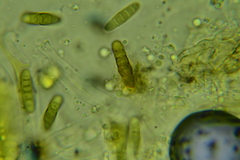 Phaeosphaeriopsis glaucopunctata